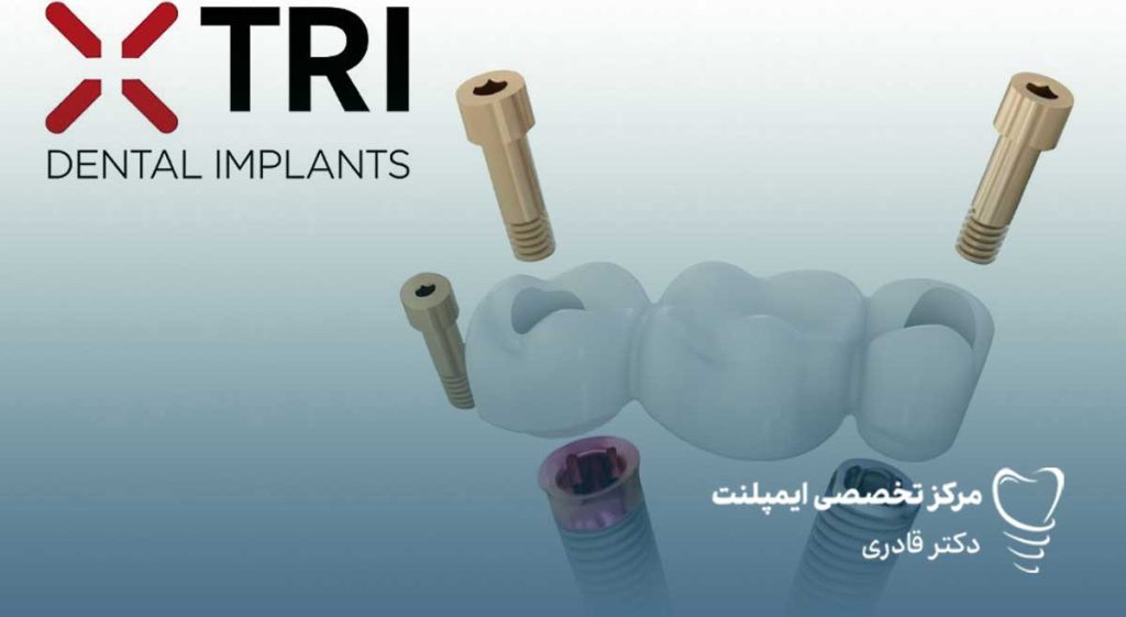 قیمت ایمپلنت TRI سوئیسی