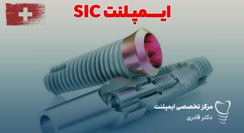 جدیدترین برندهای ایمپلنت