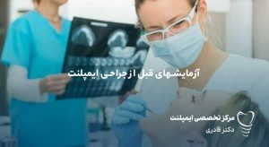 آزمایشهای قبل از جراحی ایمپلنت