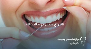 تاثیر نخ دندان در سلامت لثه